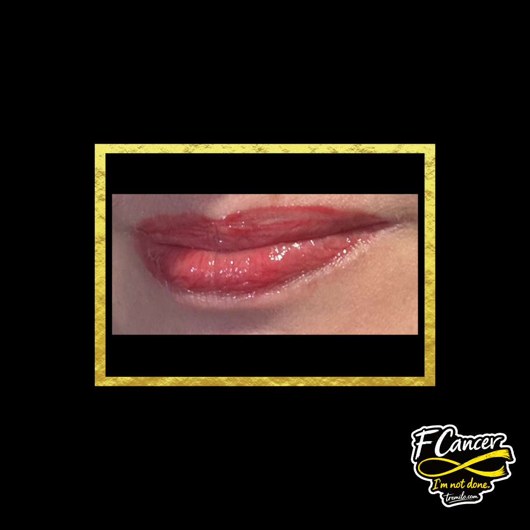 F CANCER lip gloss worn on lips — high-shine red gloss with smooth non-sticky finish
